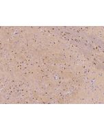 Anti-CD160 Antibody, Rabbit Polyclonal sinobiological 109318-T08