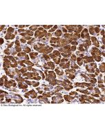 Anti-Carboxypeptidase A Antibody, Rabbit Polyclonal sinobiological 10504-RP02
