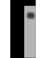 Monkeypox Virus (MPXV) B21R Antibody, Rabbit PAb, Antigen Affinity Purified sinobiological 110395-T46