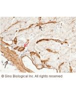 Recombinant Anti-CD146/MCAM Antibody, Rabbit Monoclonal sinobiological 10115-R005