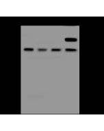 Anti-Prostatic Acid Phosphatase/ACPP Antibody, Rabbit Polyclonal sinobiological 206210-T40