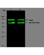 Anti-CPNE1 Antibody, Rabbit Polyclonal sinobiological 14283-T52