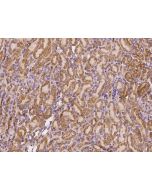 Anti-CD164 Antibody, Rabbit Polyclonal sinobiological 108952-T08