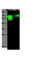 Influenza H18N11 (A/flat-faced bat/Peru/033/2010) Hemagglutinin / HA1 Antibody, Rabbit PAb, Antigen Affinity Purified sinobiological 40324-T62
