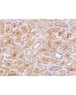 Anti-BEX4 Antibody, Rabbit Polyclonal sinobiological 205036-T08