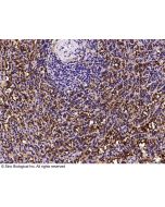 Anti-CD16a/FCGR3A/Fc gamma RIIIA Antibody, Mouse Monoclonal sinobiological 10389-MM04