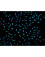 Anti-DRP2 Antibody, Rabbit Polyclonal sinobiological 206813-T02