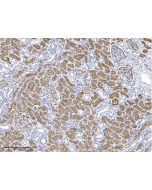 Anti-Aminopeptidase A Antibody, Rabbit Polyclonal sinobiological 10554-T24