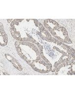 Anti-HADH Antibody, Rabbit Polyclonal sinobiological 104953-T10