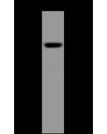 Anti-CRELD1 Antibody, Rabbit Polyclonal sinobiological 13411-T52