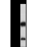 Anti-Carbonic Anhydrase IV/CA4 Antibody, Rabbit Polyclonal sinobiological 50350-T44