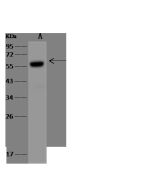 Anti-IMPDH2 Antibody, Rabbit Polyclonal sinobiological 201279-T44
