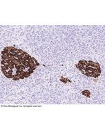 Anti-Chromogranin A/CHGA Antibody, Rabbit Polyclonal sinobiological 100747-T08