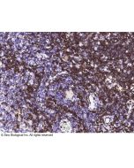 Anti-CD6 Antibody, Rabbit Polyclonal sinobiological 80311-T24