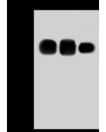 Anti-Mesothelin Antibody, Rabbit Polyclonal sinobiological 13128-T60