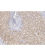 Anti-ATP5A1 Antibody, Rabbit Polyclonal sinobiological 104721-T08
