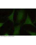 Anti-eIF3K Antibody, Mouse Monoclonal sinobiological 14553-MM01