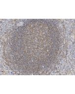 Anti-CD40/TNFRSF5 Antibody, Rabbit Polyclonal sinobiological 90097-T24