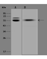 Anti-Desmin Antibody, Rabbit Polyclonal sinobiological 310178-T40