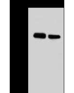 Anti-AKT1S1/PRAS40 Antibody, Rabbit Polyclonal sinobiological 112217-T44