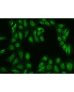 Anti-ARL2BP Antibody, Rabbit Polyclonal sinobiological 203552-T02