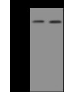 Anti-A1BG Antibody, Rabbit Polyclonal sinobiological 207096-T32