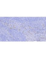 Anti-Human Annexin A1/ANXA1 Antibody, Mouse MAb sinobiological IHC001