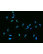 Anti-H2AFM/HIST1H2AB Antibody, Rabbit Polyclonal sinobiological 101245-T42