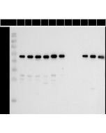 SARS-CoV-2 Nucleocapsid Antibody, Mouse MAb sinobiological 40588-MM170