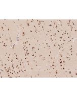 Anti-AIPL1 Antibody, Rabbit Polyclonal sinobiological 207288-T10