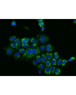 Anti-DKK-3 Antibody, Rabbit Polyclonal sinobiological 10203-T50