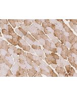 Anti-CSRP3 Antibody, Rabbit Polyclonal sinobiological 201969-T08