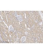 Anti-Contactin-4 Antibody, Rabbit Polyclonal sinobiological 10178-T24