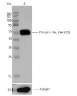 Phospho-Tau (Ser202) Antibody, Rabbit MAb sinobiological 110926-R0010