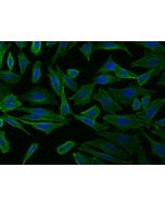 Anti-Glypican 3/GPC3 Antibody, Rabbit Polyclonal sinobiological 100393-T02