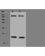 Anti-ARID1A Antibody, Rabbit Polyclonal sinobiological 204010-T42