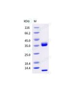 Recombinant Cynomolgus FCGRT & B2M Heterodimer Protein (His & AVI Tag), Biotinylated, HPLC-verified sinobiological CT084-C27H-B