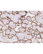 Anti-Aromatase/CYP19A1 Antibody, Rabbit Polyclonal sinobiological 201237-T08