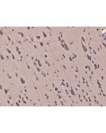 Anti-HERC2 Antibody, Rabbit Polyclonal sinobiological 204489-T08