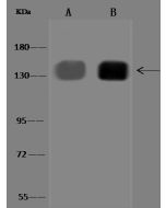 Anti-Integrin alpha 5/CD49e/ITGA5 Antibody, Rabbit Polyclonal sinobiological 310398-T36