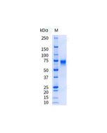 Recombinant Human AXL Protein (ECD, His Tag), HPLC-verified, Endotoxin-Free sinobiological 10279-H08H-UE