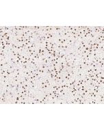 Anti-Cyclin T1/CCNT1 Antibody, Rabbit Polyclonal sinobiological 207636-T10