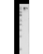 Ebola virus EBOV (subtype Zaire, strain Ebola virus H.sapiens-wt/SLE/2014/ManoRiver-G3686.1) Glycoprotein / EBOV-G Antibody, Rabbit PAb, Antigen Affinity Purified sinobiological 40459-T62