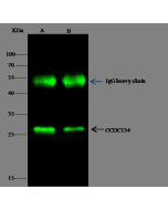 Anti-CCDC134 Antibody, Rabbit Polyclonal sinobiological 13168-T52
