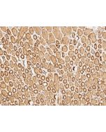 Anti-HAS1 Antibody, Rabbit Polyclonal sinobiological 206085-T08