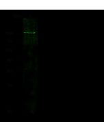 Recombinant Anti-ADAM12 Antibody, Rabbit Monoclonal sinobiological 10896-R737