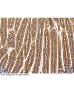 Anti-IL-36 beta/IL-1 F8 Antibody, Rabbit Polyclonal sinobiological 51071-T24