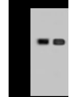 Anti-CD38 Antibody, Rabbit Polyclonal sinobiological 10818-T58