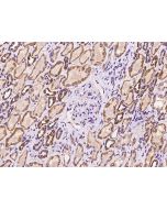 Anti-ISCA2/HBLD1 Antibody, Rabbit Polyclonal sinobiological 204161-T08