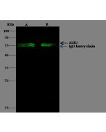 Recombinant Anti-ALK-1 Antibody, Rabbit Monoclonal sinobiological 10066-R124